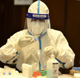 यी अस्पतालमा वैदेशिक रोजगारीमा जानेकाे निःशुल्क पीसीआर,के चाहिन्छ कागजात?