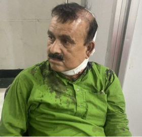 कांग्रेस सहमहामन्त्री यादवमाथि खुकुरी प्रहार